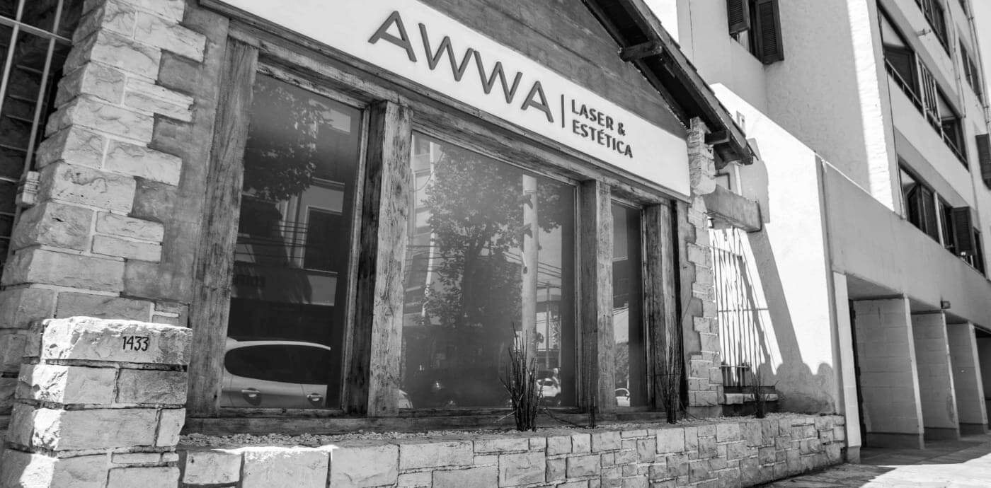 awwa laser en Roca 1522 1A, Mar del plata